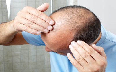 Non-Surgical Hair Replacement in Amherst, NY: A Revolutionary Solution for Effortless, Natural-Looking Hair Restoration