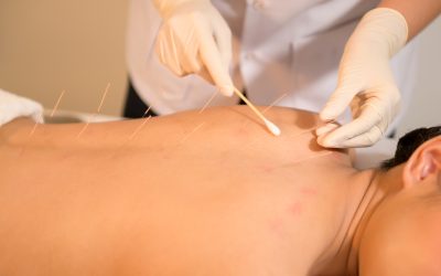 Understanding the Benefits and Side Effects of Shockwave Therapy