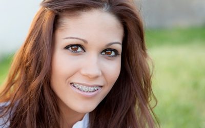 Straighten Your Smile Confidently with Clear Braces Fort Lauderdale, FL Professionals