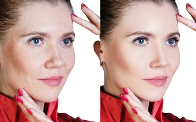 Natural-Looking Results with Facelift Bloomfield Hills MI for Lasting Youthful Confidence