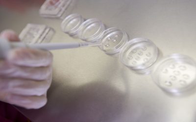 Choosing Embryo Transfer in Orange County, CA for Personalized Fertility Solutions